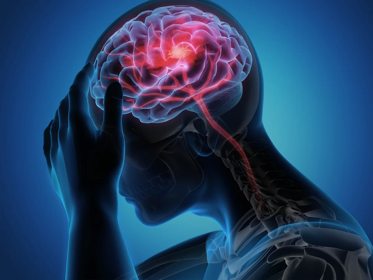 How to Recognize the Signs and Symptoms of a Stroke?