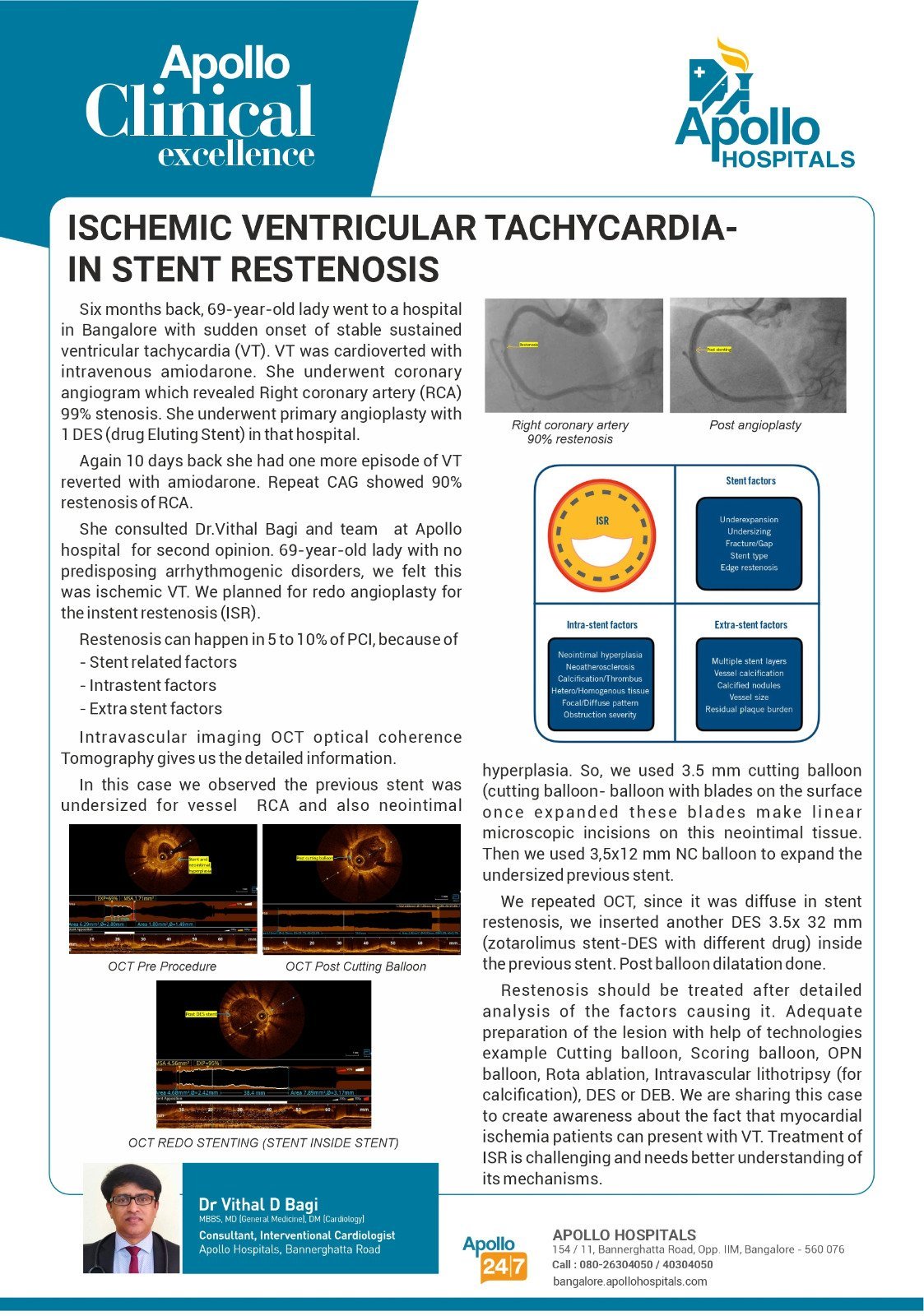 Supporting image for this heart-health article