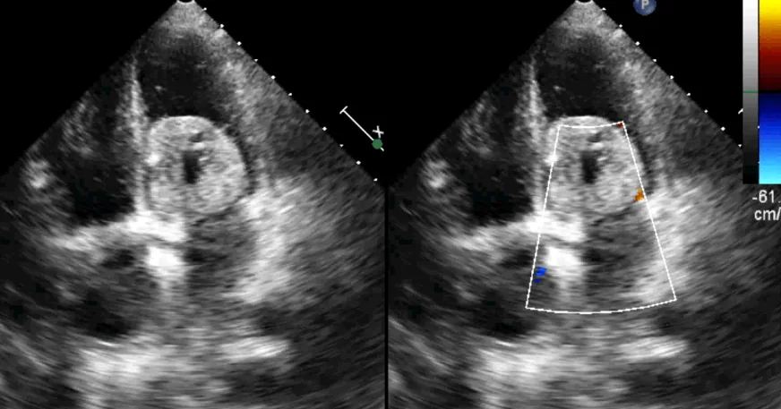 Cardiologist Consultation